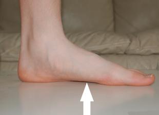 Qu'est-ce qui vous fera mal si vous avez les pieds plats ?